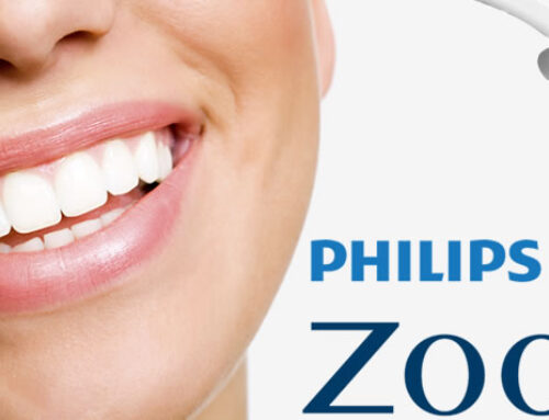 Zoom Teeth Whitening Service in QueenswayDentalPractice