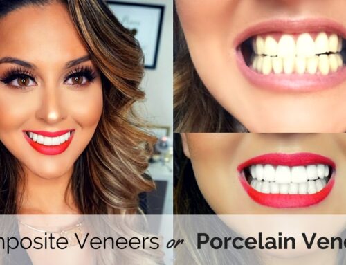Queensway Dental Practice – Porcelain & Composite Veneers