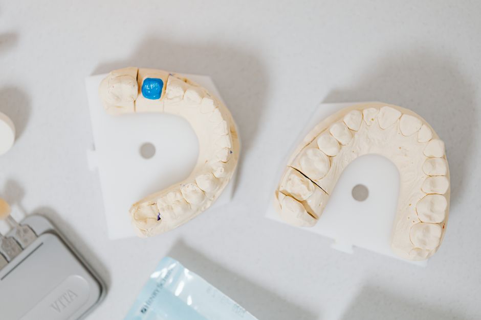 pexels-photo-6627601-6627601 Close-up of dental molds on a white table, showcasing orthodontic details.