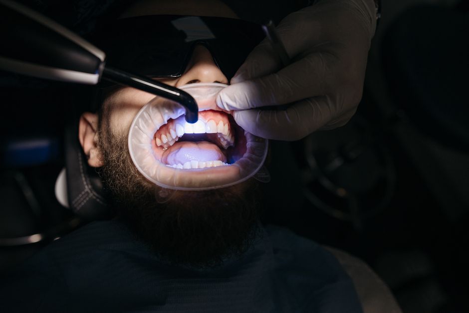 pexels-photo-6812547-6812547 Close-up of dentist using ultraviolet light on a patient's teeth.